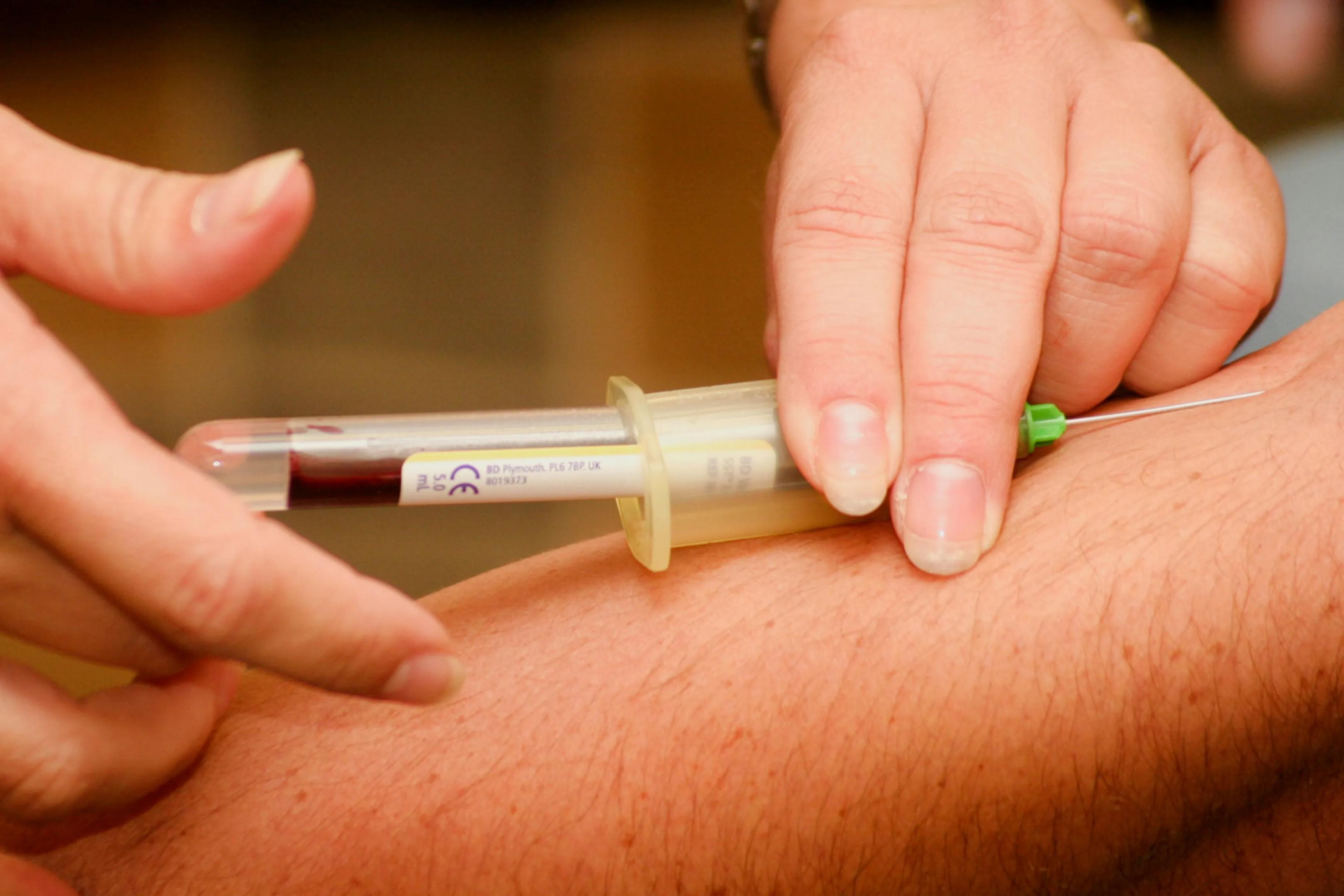 High cholesterol levels can only be checked via a blood test.