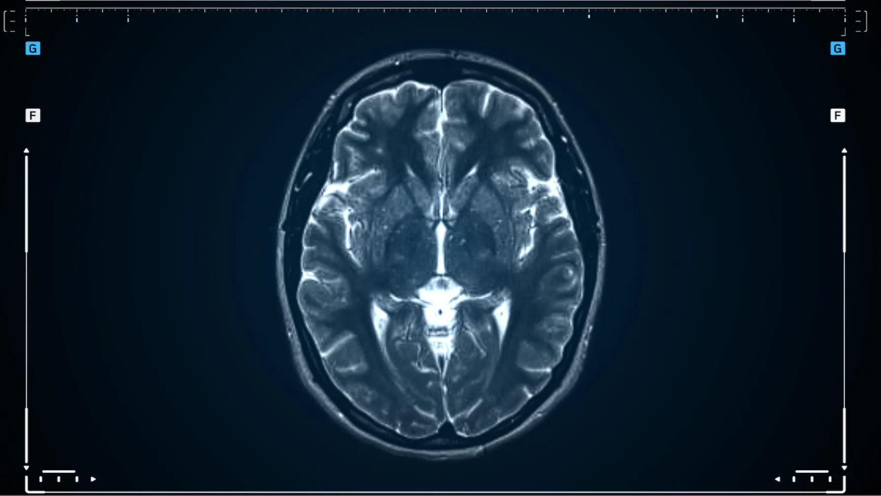 We don't need to soley rely on artificial intelligence if we concentrate on improving brain health.