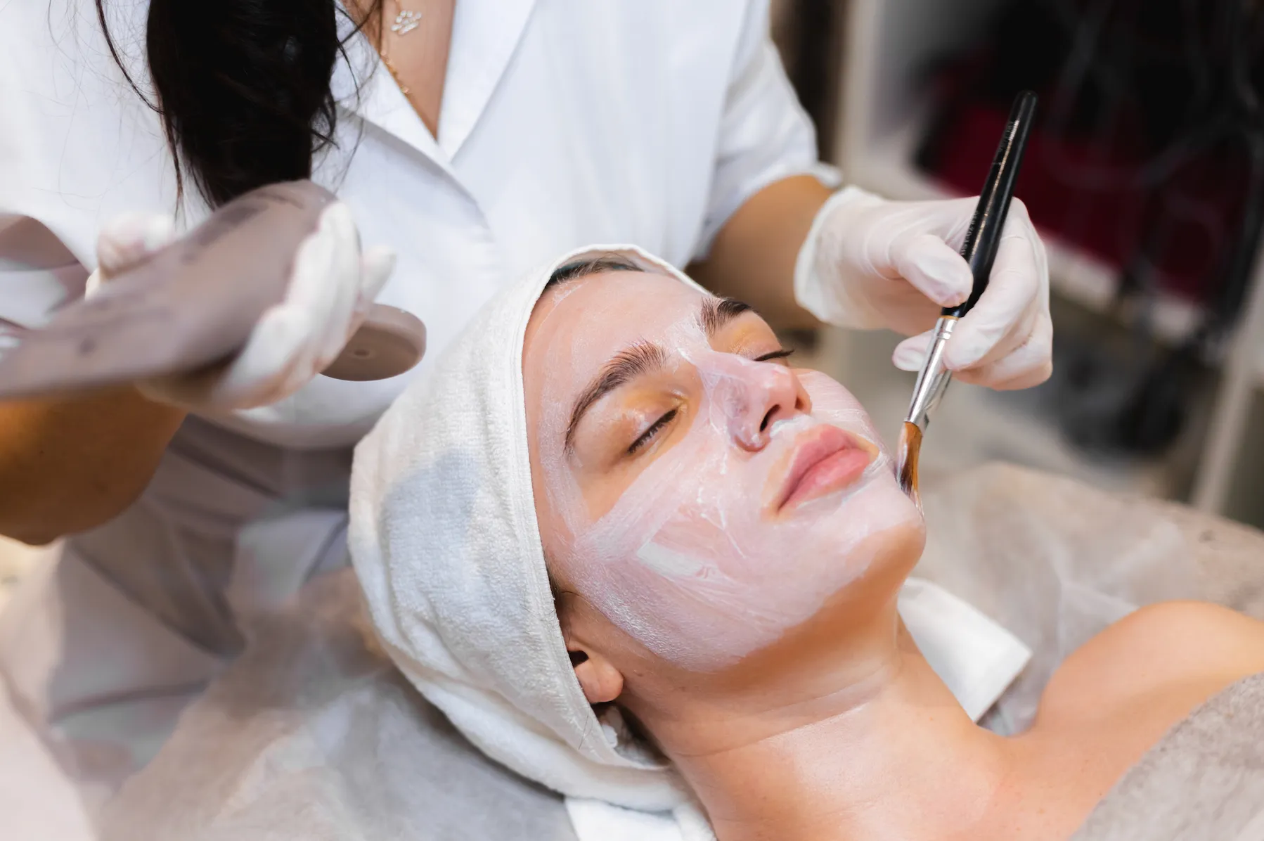 To treat acne you should stay away from fields like cosmetic and clinical dermatology but go for natural options like aloe vera and coconut water. 