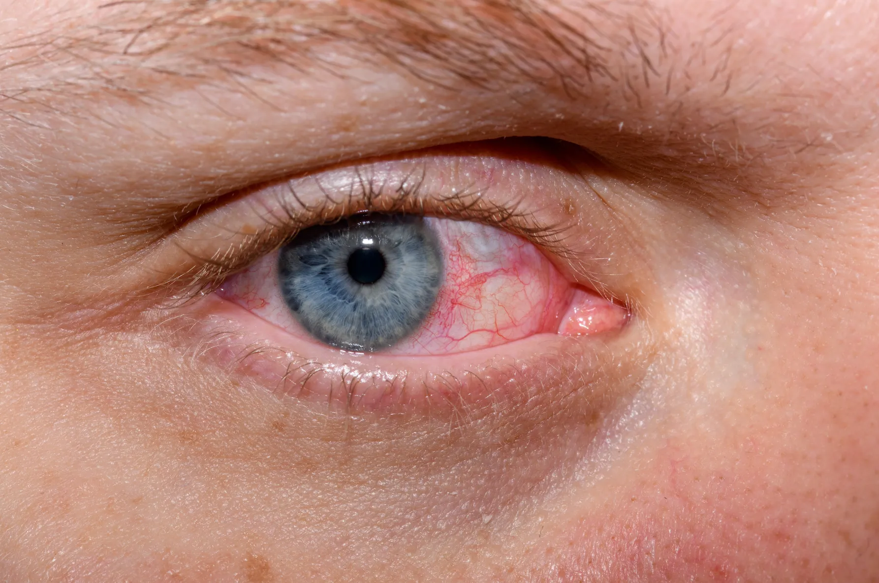 Red light therapy works quickly but results may only start to show one week post exposure